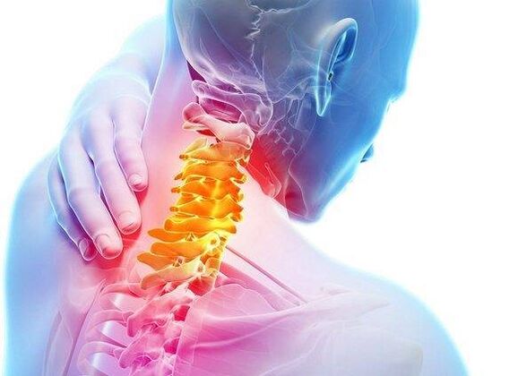 osteochondróza