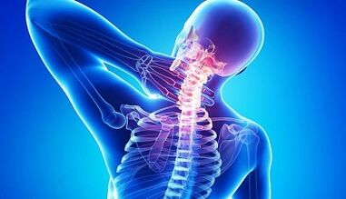 Príznaky a liečba krčnej osteochondrózy